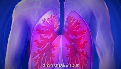 آفت کش ها در محل کار احتمال مبتلاشدن به بیماری ریوی را بیشتر می کند