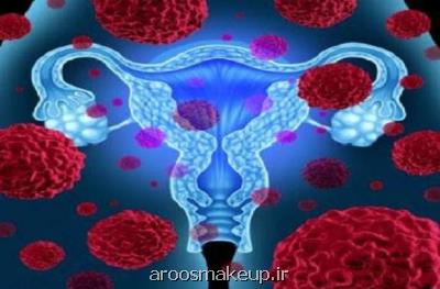 ارتباط ژنتیکی اندومتریوز و سرطان تخمدان