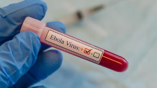 گسترش شیوع ابولا به شرق اوگاندا