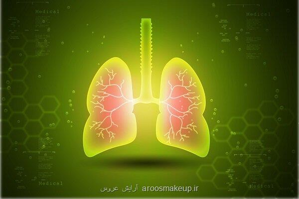 دستگاه تهویه هوا برای قلب بیماران انسداد مزمن ریوی مفید می باشد