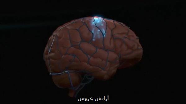 بزرگسالان مبتلا به اختلال بیش فعالی در معرض افزایش ریسک زوال عقل
