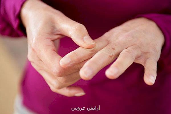 تغییرات هورمونی ممکن است سبب ایجاد آرتریت روماتوئید در زنان شود