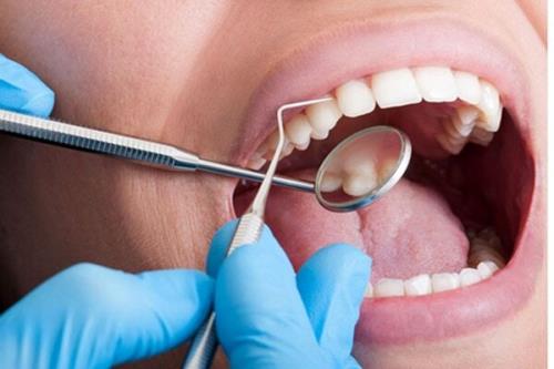 رفتن به دندانپزشکی در دوران حاملگی آری یا خیر؟