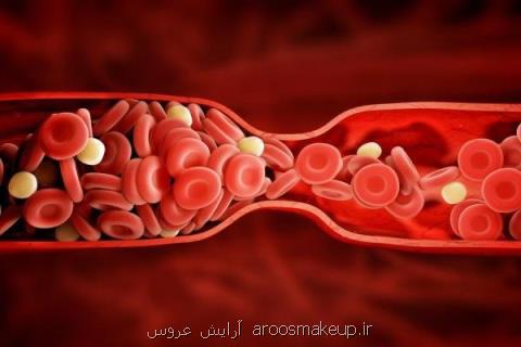 فاكتورهای پرخطر لخته شدن خون را بشناسیم