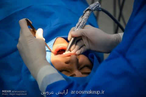 وضعیت اسفبار سلامت دهان و دندان ایرانی ها، ۳۰۰ میلیون دندان خراب