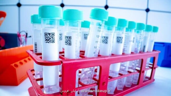 آزمایش تست كرونا با نمونه بزاق در انگلیس