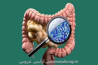 نقش میكروب های روده در بروز بیماری اوتیسم